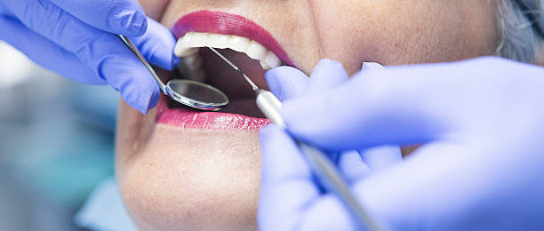 Best Urgent Care for Lost Fillings or Crowns in Marathon, FL